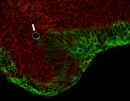 Droplet in Tissue